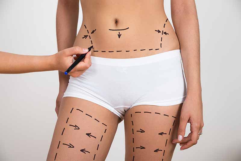 cosmetic surgery in Los Angeles