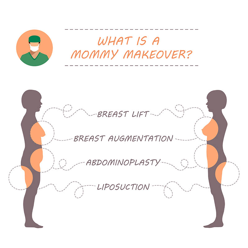 Cosmetic Surgery in Venice for a Mommy Makeover